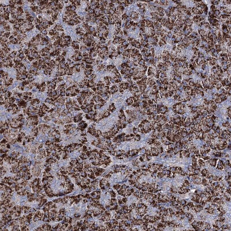 CPLANE1 Antibody - BSA Free Immunohistochemistry: CPLANE1 Antibody - BSA Free [NBP1-94023]