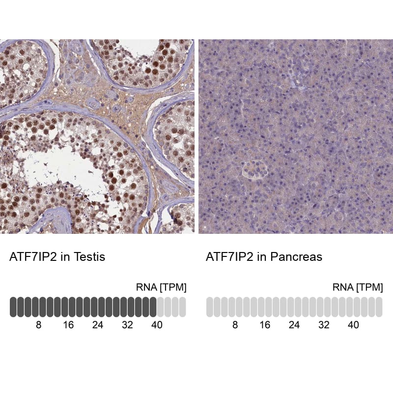 ATF7IP2 Antibody - BSA Free Immunohistochemistry: ATF7IP2 Antibody - BSA Free [NBP1-94028]
