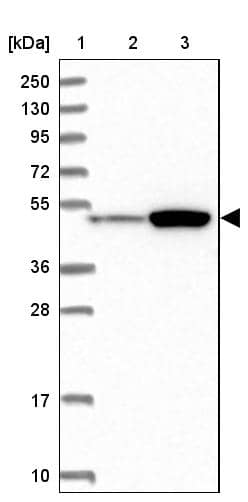 ATF7IP2 Antibody - BSA Free Western Blot: ATF7IP2 Antibody - BSA Free [NBP1-94029]