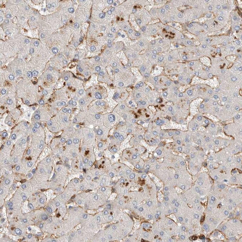 JMJD4 Antibody - BSA Free Immunohistochemistry: JMJD4 Antibody - BSA Free [NBP1-94032]