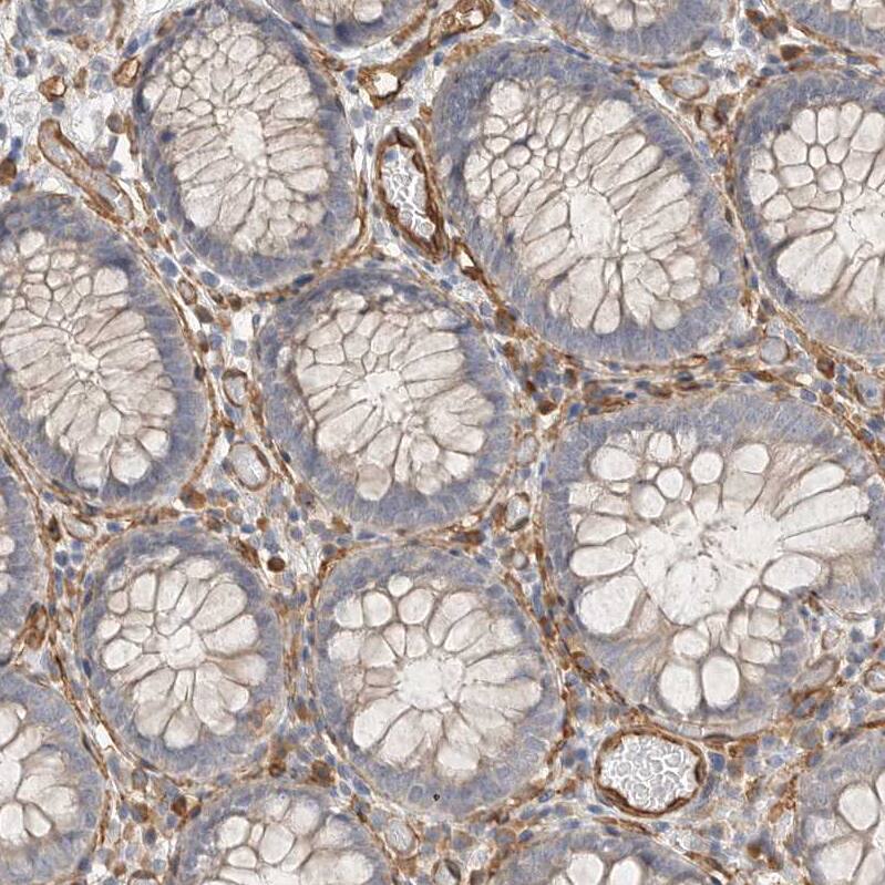 JMJD4 Antibody - BSA Free Immunohistochemistry: JMJD4 Antibody - BSA Free [NBP1-94032]