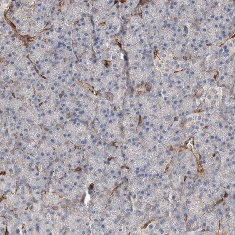 JMJD4 Antibody - BSA Free Immunohistochemistry: JMJD4 Antibody - BSA Free [NBP1-94032]