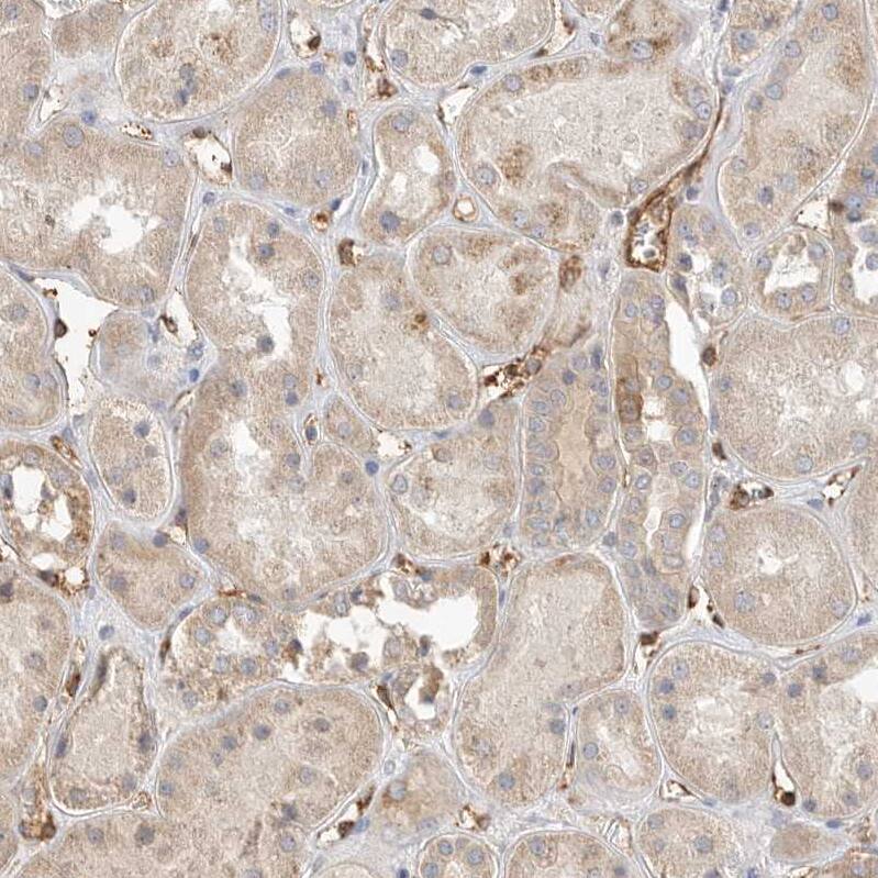 JMJD4 Antibody - BSA Free Immunohistochemistry: JMJD4 Antibody - BSA Free [NBP1-94032]