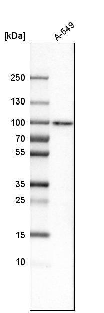SAMD4B Antibody - BSA Free Western Blot: SAMD4B Antibody - BSA Free [NBP1-94045]