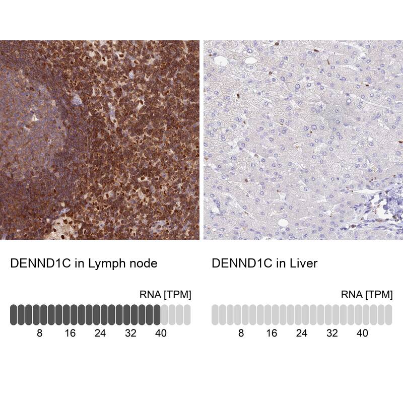 DENND1C Antibody - BSA Free Immunohistochemistry: DENND1C Antibody - BSA Free [NBP1-94051]