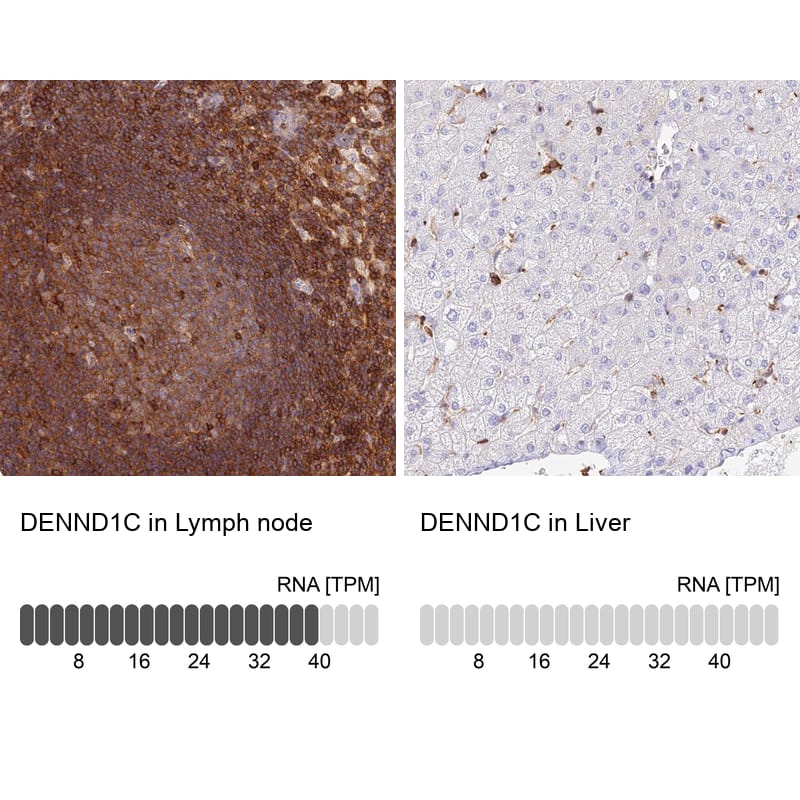 DENND1C Antibody - BSA Free Immunohistochemistry: DENND1C Antibody - BSA Free [NBP1-94052]