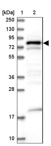 DENND1C Antibody - BSA Free Western Blot: DENND1C Antibody - BSA Free [NBP1-94052]