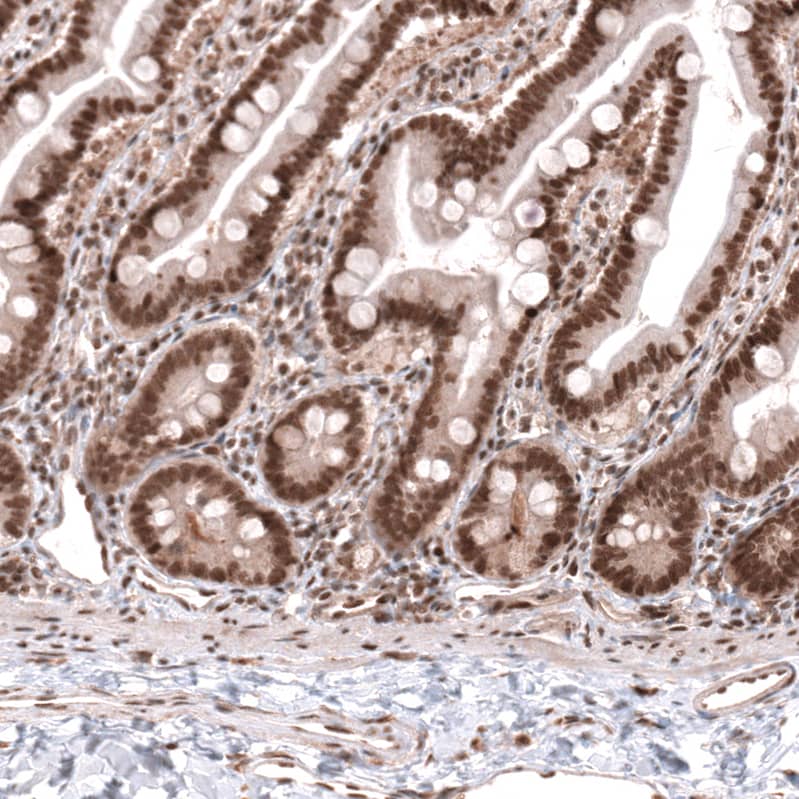 KANSL1 Antibody - BSA Free Immunohistochemistry: KANSL1 Antibody - BSA Free [NBP1-94065]