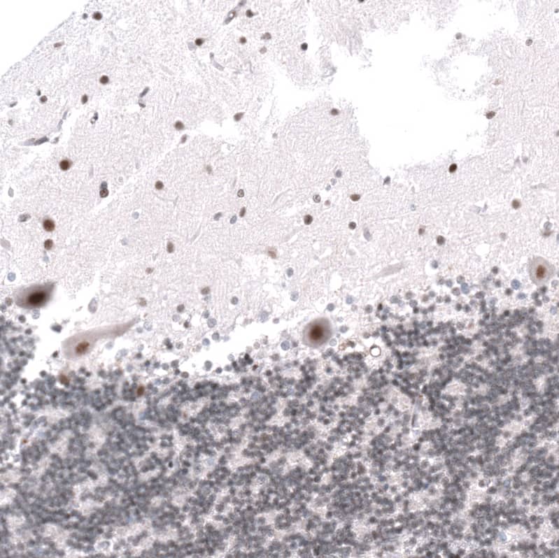 KANSL1 Antibody - BSA Free Immunohistochemistry: KANSL1 Antibody - BSA Free [NBP1-94065]