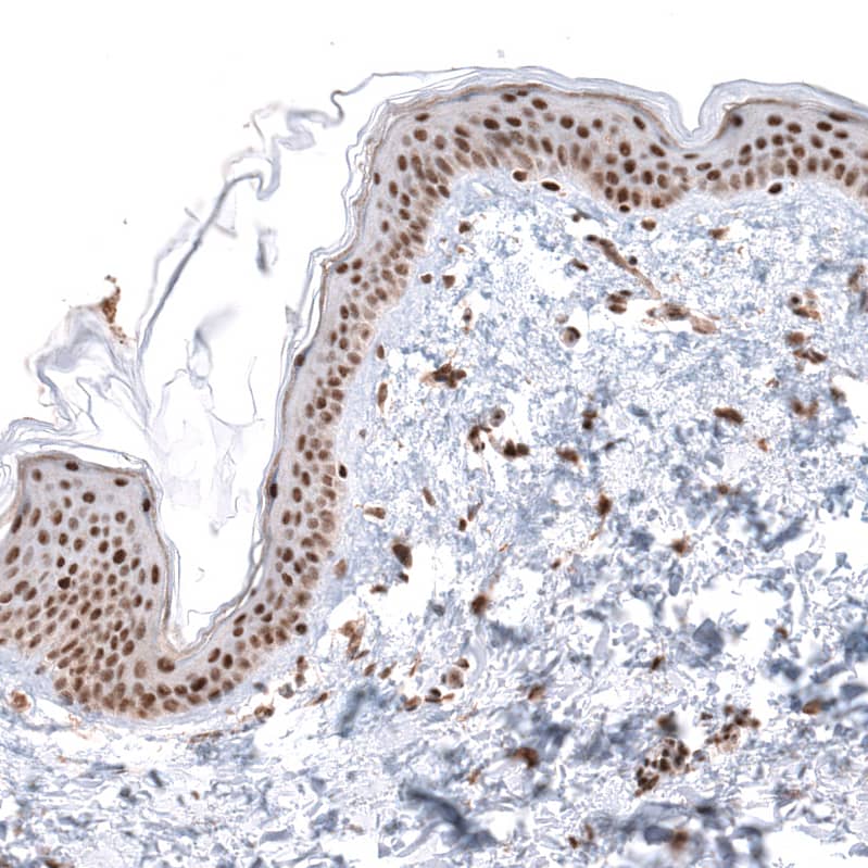 KANSL1 Antibody - BSA Free Immunohistochemistry: KANSL1 Antibody - BSA Free [NBP1-94065]