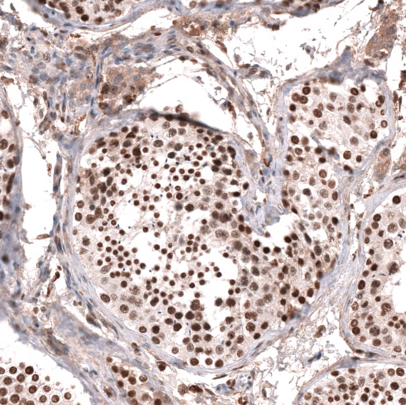 KANSL1 Antibody - BSA Free Immunohistochemistry: KANSL1 Antibody - BSA Free [NBP1-94065]