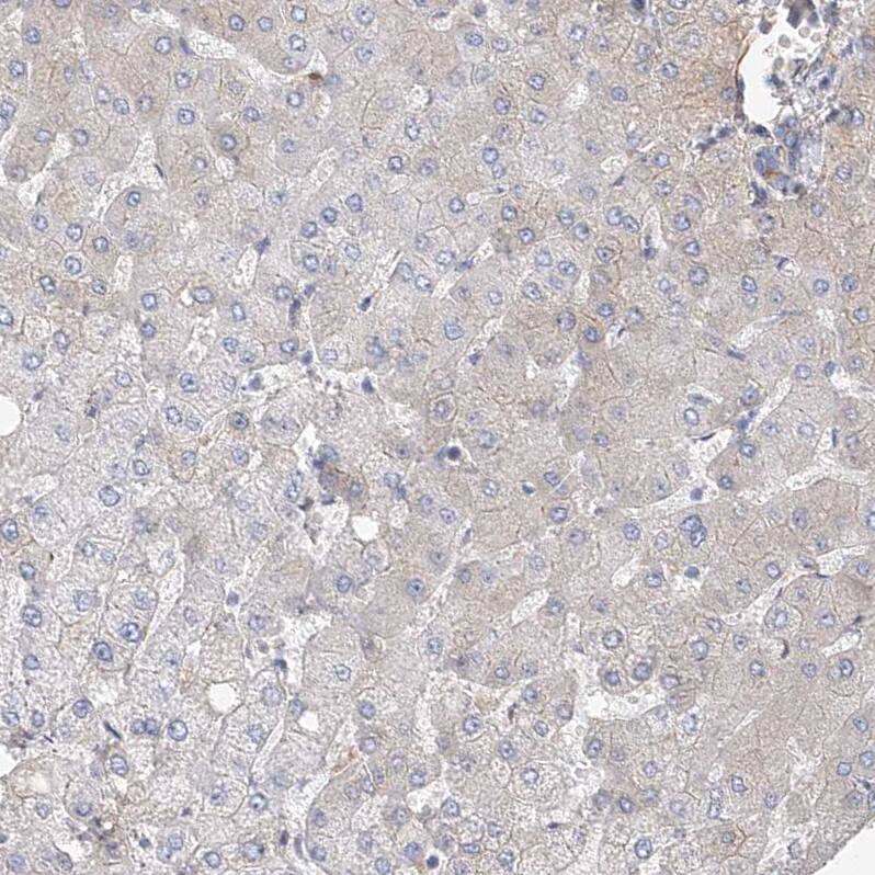 FRYL Antibody - BSA Free Immunohistochemistry: FRYL Antibody - BSA Free [NBP1-94071]