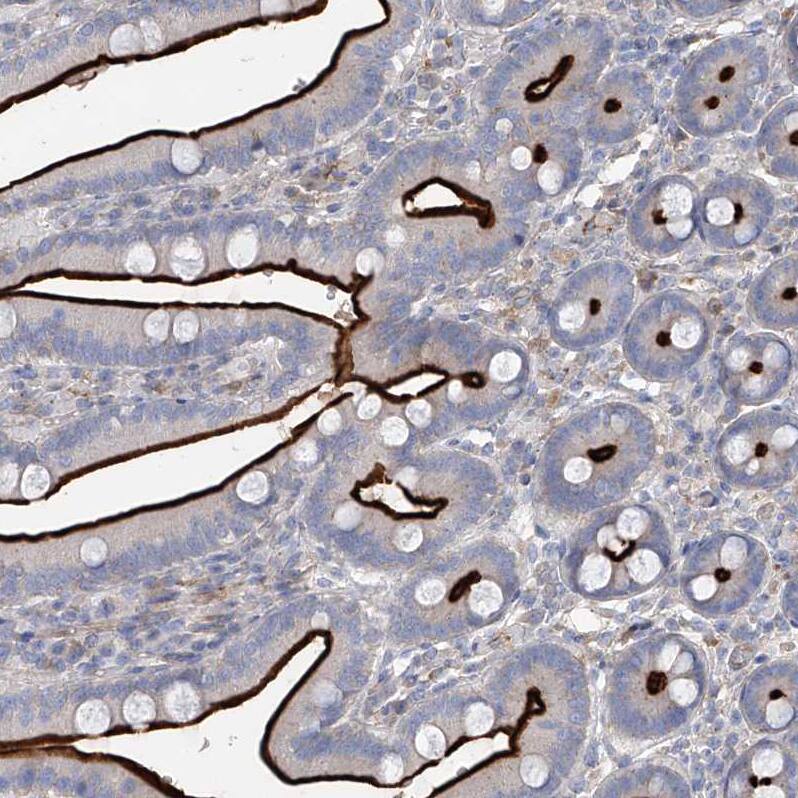 FRYL Antibody - BSA Free Immunohistochemistry: FRYL Antibody - BSA Free [NBP1-94071]