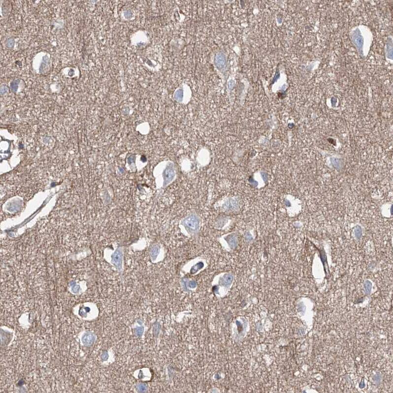 FRYL Antibody - BSA Free Immunohistochemistry: FRYL Antibody - BSA Free [NBP1-94071]