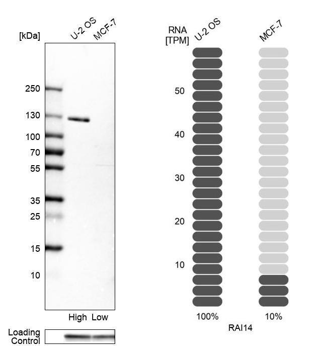 RAI14 Antibody - BSA Free Western Blot: RAI14 Antibody - BSA Free [NBP1-94075]