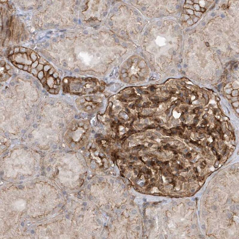 RAI14 Antibody - BSA Free Immunohistochemistry: RAI14 Antibody - BSA Free [NBP1-94075]
