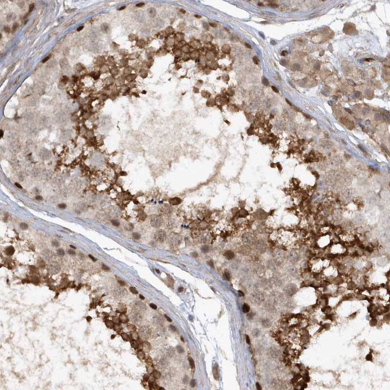 RAI14 Antibody - BSA Free Immunohistochemistry: RAI14 Antibody - BSA Free [NBP1-94075]
