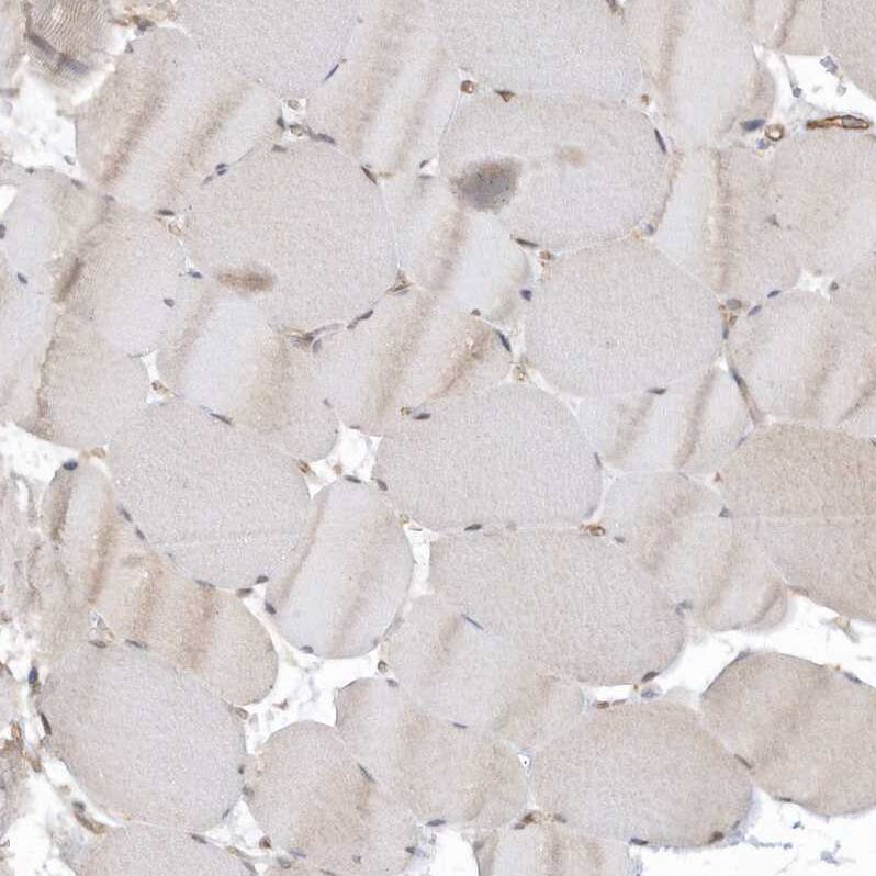 RAI14 Antibody - BSA Free Immunohistochemistry: RAI14 Antibody - BSA Free [NBP1-94075]