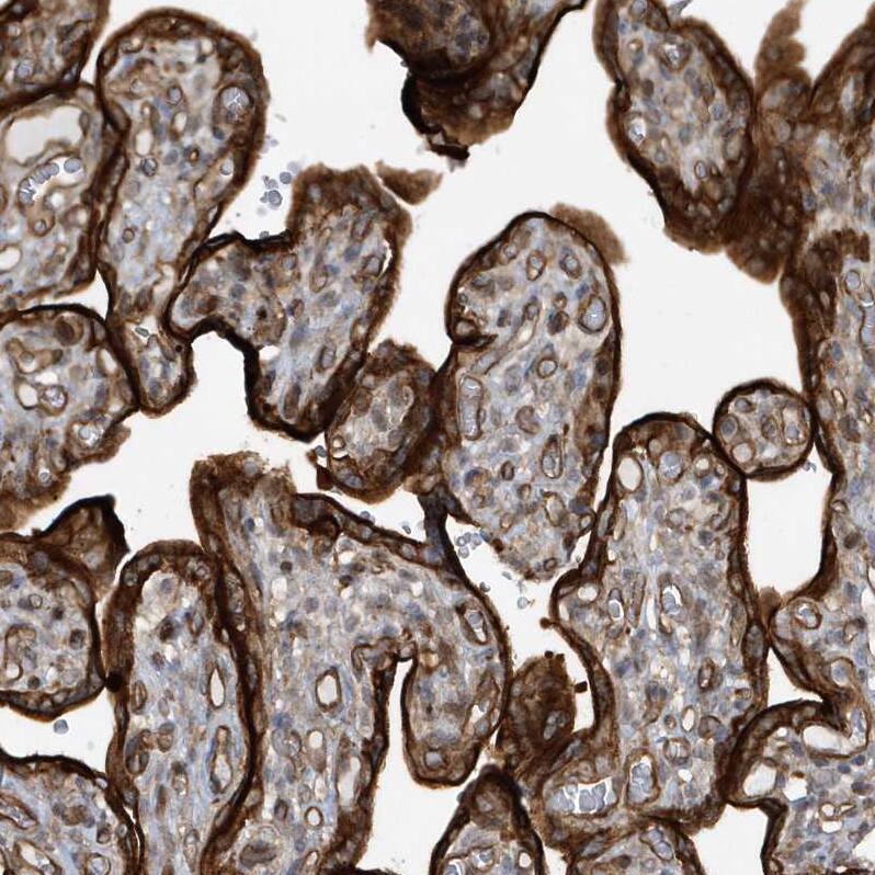 RAI14 Antibody - BSA Free Immunohistochemistry: RAI14 Antibody - BSA Free [NBP1-94075]