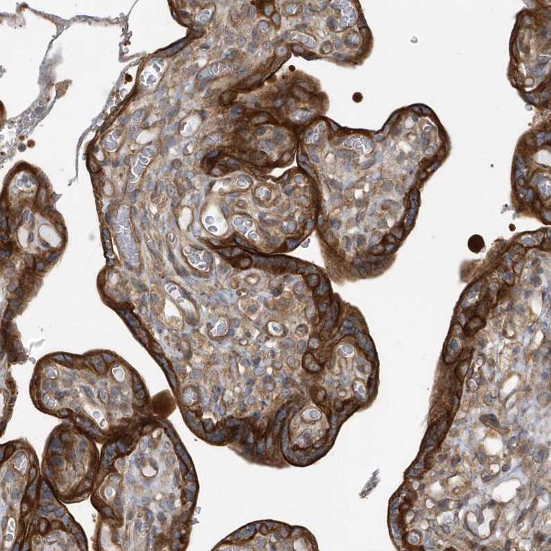 RAI14 Antibody - BSA Free Immunohistochemistry: RAI14 Antibody - BSA Free [NBP1-94076]