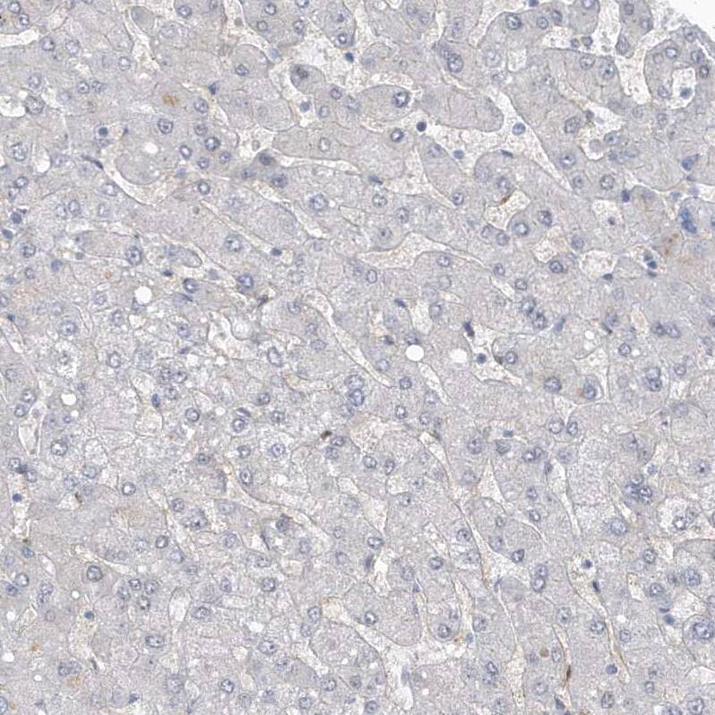 RAI14 Antibody - BSA Free Immunohistochemistry: RAI14 Antibody - BSA Free [NBP1-94076]