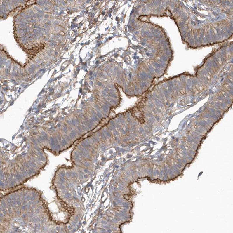 RAI14 Antibody - BSA Free Immunohistochemistry: RAI14 Antibody - BSA Free [NBP1-94076]
