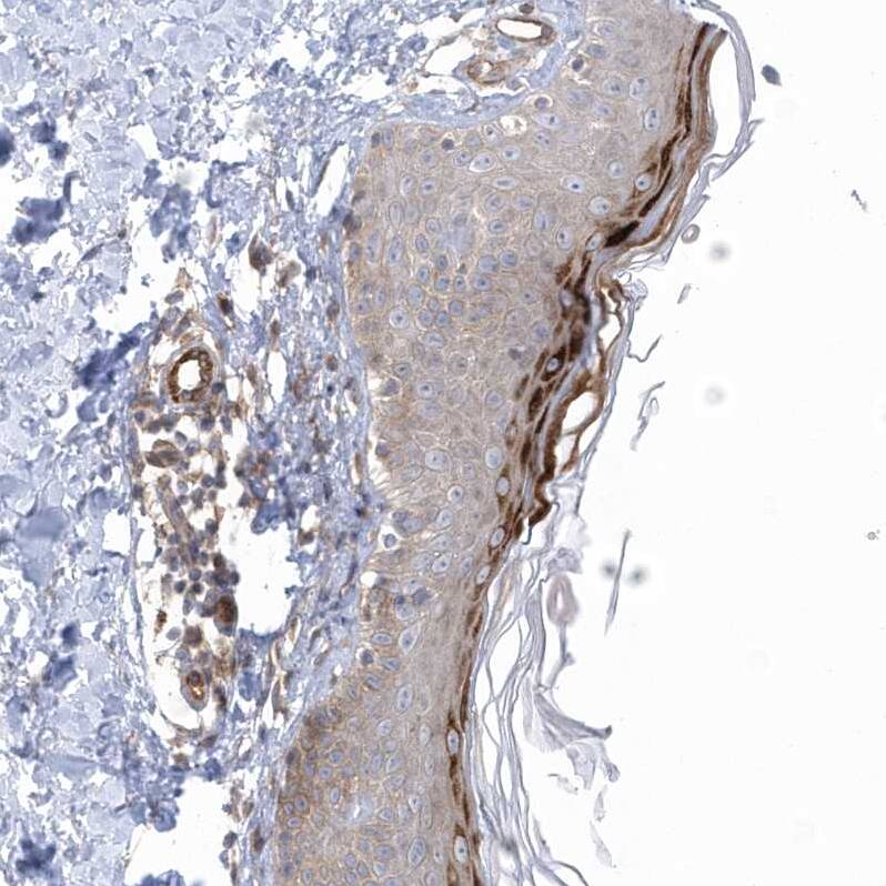 RAI14 Antibody - BSA Free Immunohistochemistry: RAI14 Antibody - BSA Free [NBP1-94076]