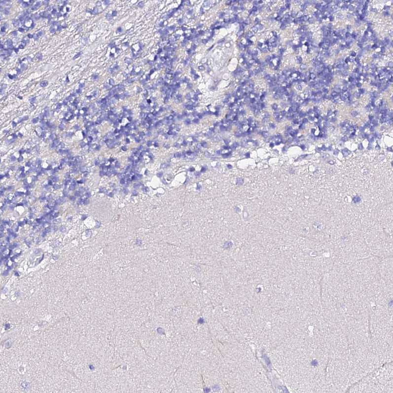 TMEM117 Antibody - BSA Free Immunohistochemistry: TMEM117 Antibody - BSA Free [NBP1-94078]