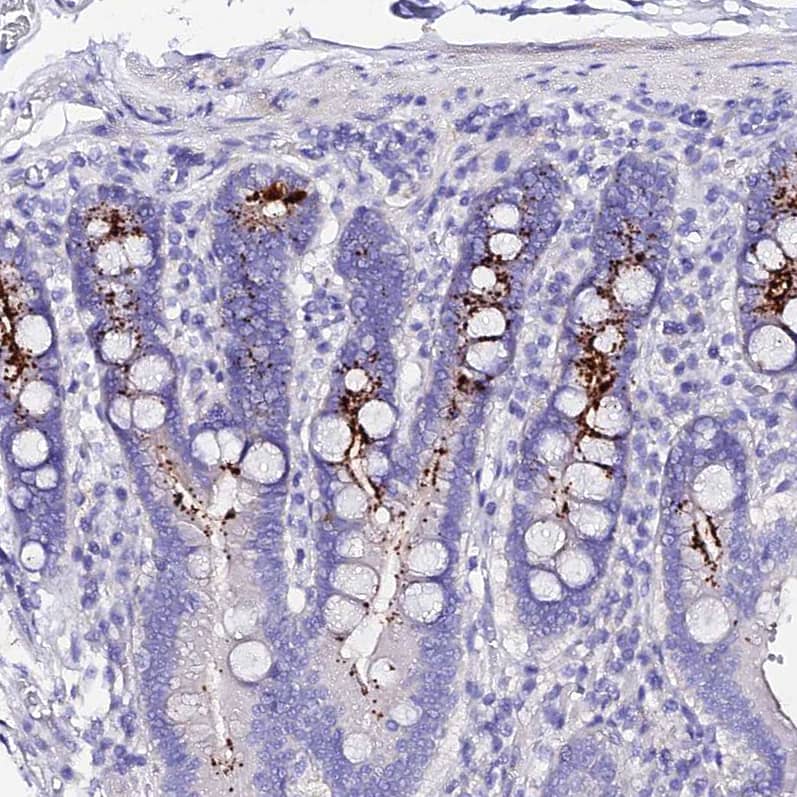 TMEM117 Antibody - BSA Free Immunohistochemistry: TMEM117 Antibody - BSA Free [NBP1-94078]