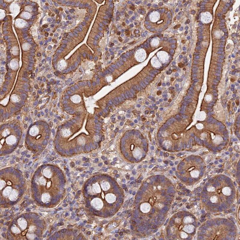 PPP1R12C Antibody - BSA Free Immunohistochemistry: PPP1R12C Antibody - BSA Free [NBP1-94079]