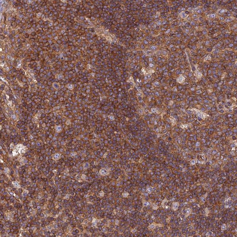 PPP1R12C Antibody - BSA Free Immunohistochemistry: PPP1R12C Antibody - BSA Free [NBP1-94079]