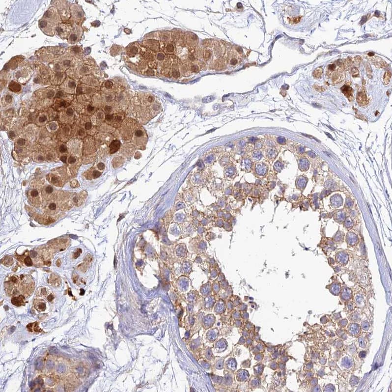 PPP1R12C Antibody - BSA Free Immunohistochemistry: PPP1R12C Antibody - BSA Free [NBP1-94079]
