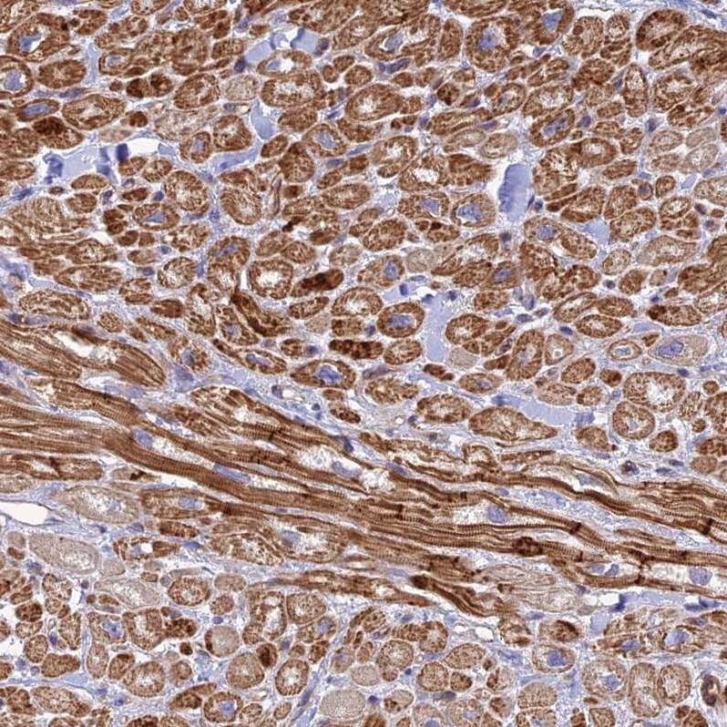 PPP1R12C Antibody - BSA Free Immunohistochemistry: PPP1R12C Antibody - BSA Free [NBP1-94079]