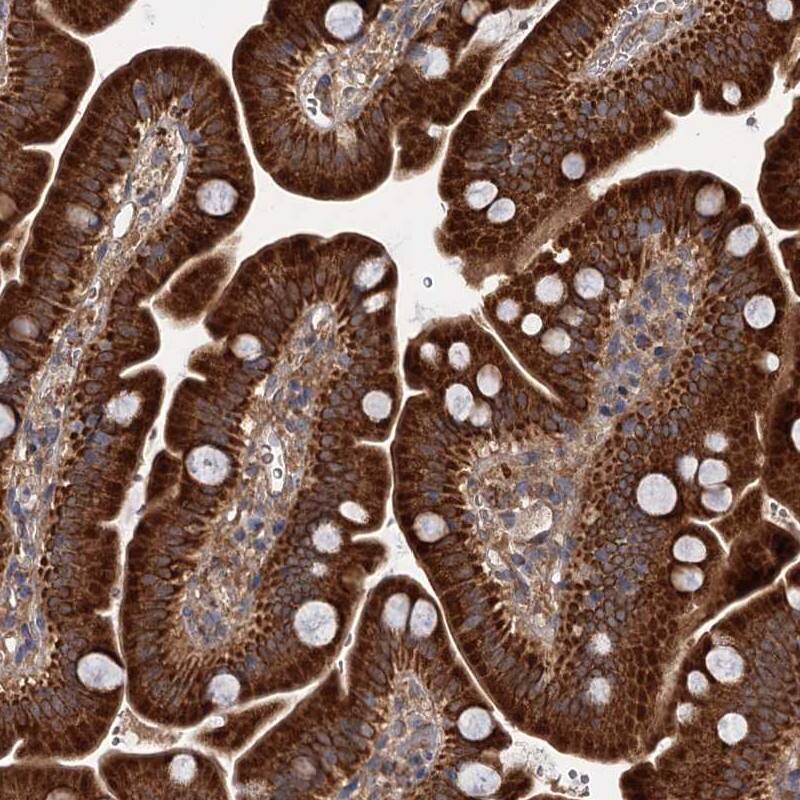 DYNC2H1 Antibody - BSA Free Immunohistochemistry-Paraffin: DYNC2H1 Antibody [NBP1-94086]