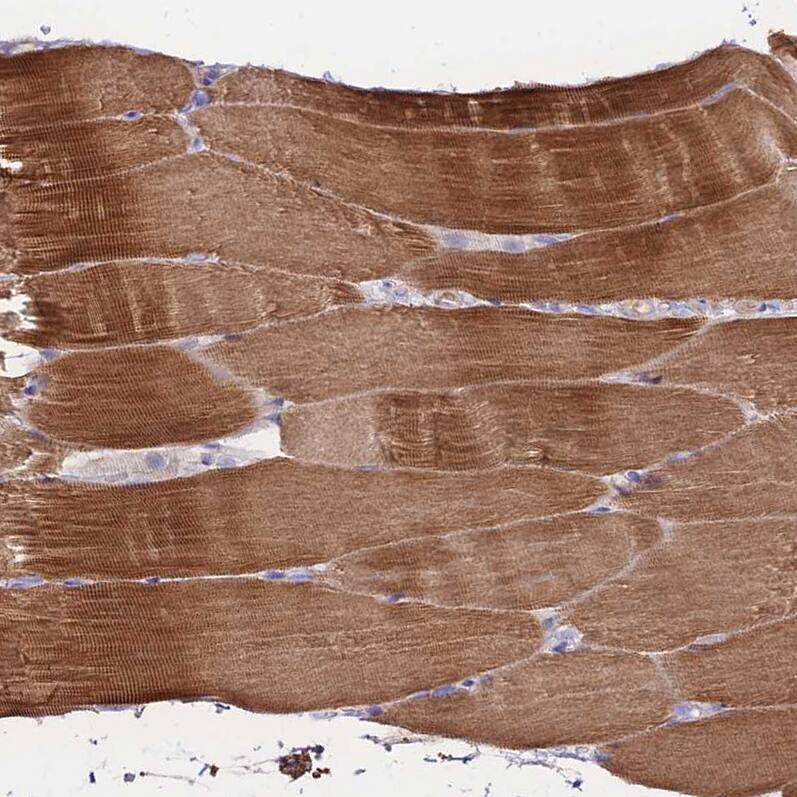 NLRP9 Antibody - BSA Free Immunohistochemistry: NLRP9 Antibody - BSA Free [NBP1-94098]