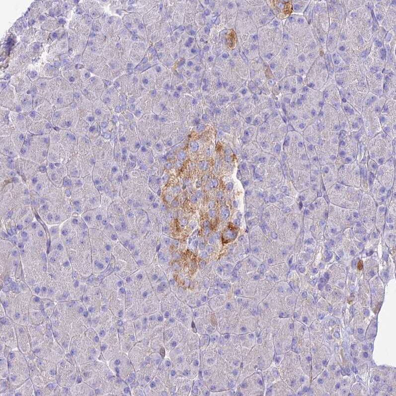 NLRP9 Antibody - BSA Free Immunohistochemistry: NLRP9 Antibody - BSA Free [NBP1-94098]