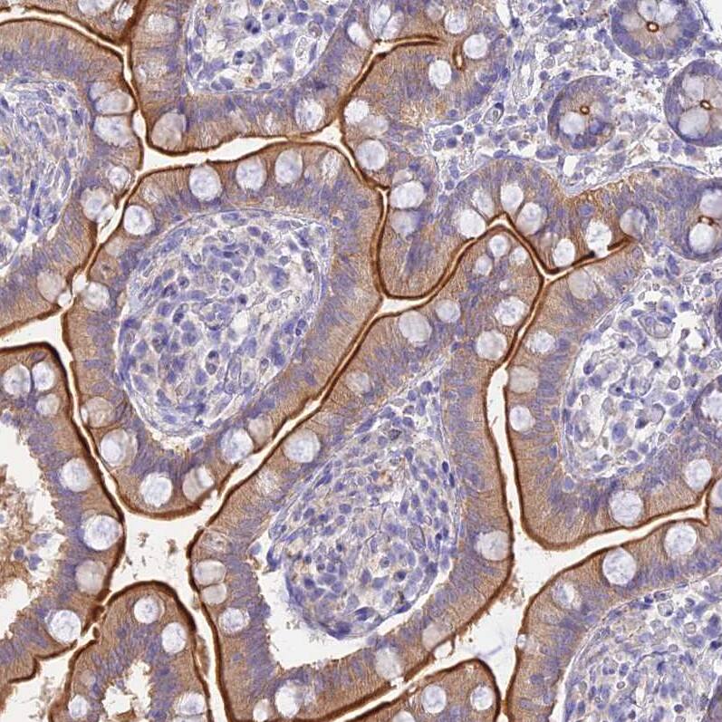 NLRP9 Antibody - BSA Free Immunohistochemistry: NLRP9 Antibody - BSA Free [NBP1-94098]