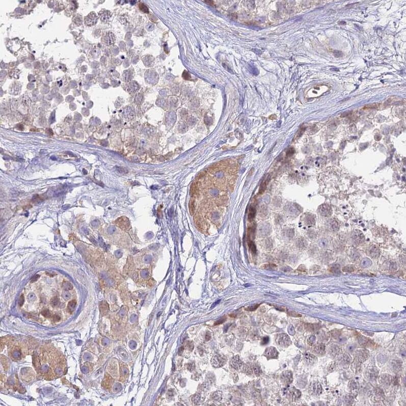 NLRP9 Antibody - BSA Free Immunohistochemistry: NLRP9 Antibody - BSA Free [NBP1-94098]