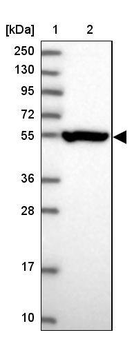 CRTAP Antibody - BSA Free Western Blot: CRTAP Antibody - BSA Free [NBP1-94104]