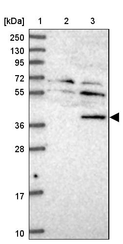 TYW5 Antibody - BSA Free Western Blot: TYW5 Antibody - BSA Free [NBP1-94109]