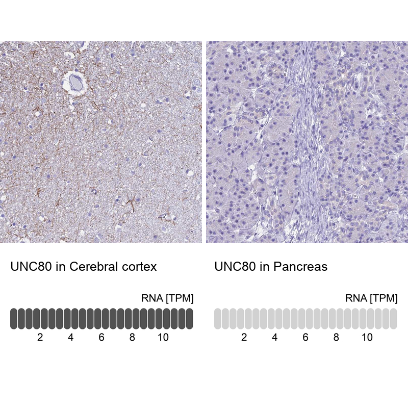 UNC80 Antibody - BSA Free Immunohistochemistry: UNC80 Antibody - BSA Free [NBP1-94110]