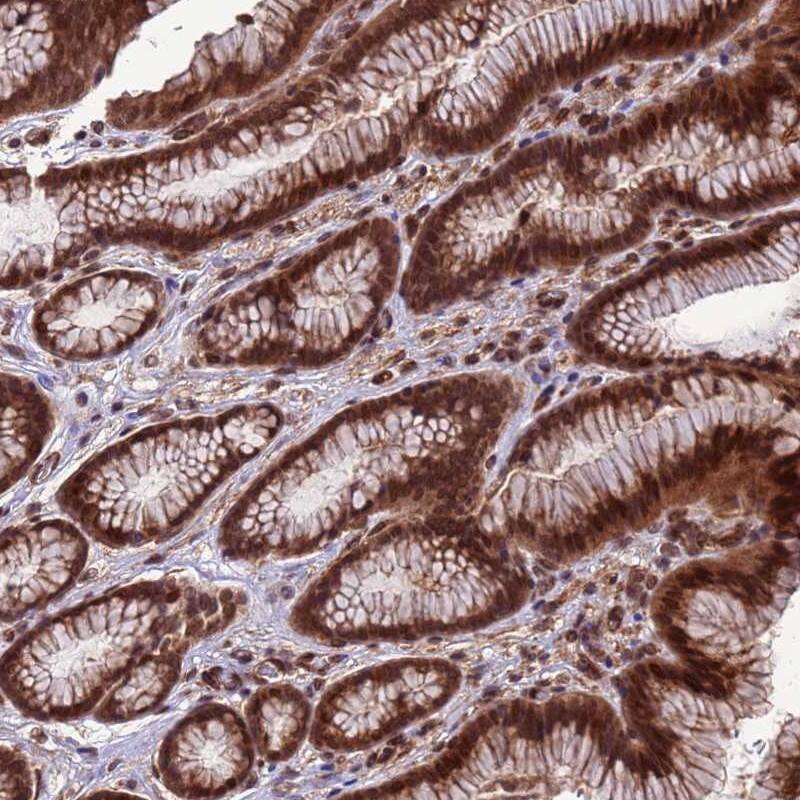 VSTM4 Antibody - BSA Free Immunohistochemistry-Paraffin: VSTM4 Antibody [NBP1-94127]