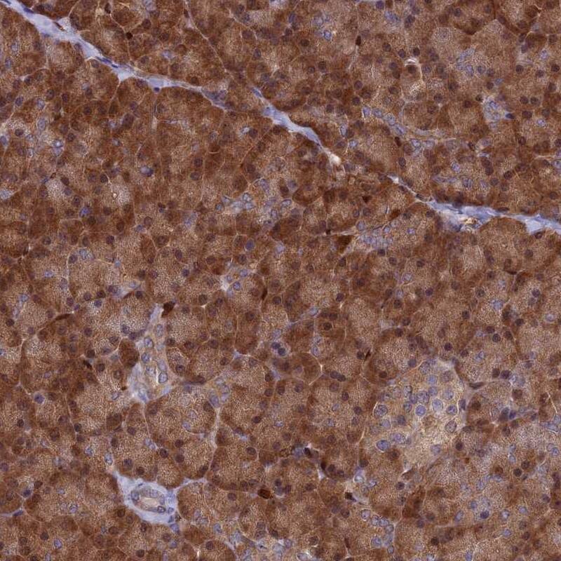 ARHGAP18 Antibody - BSA Free Immunohistochemistry: ARHGAP18 Antibody - BSA Free [NBP1-94131]