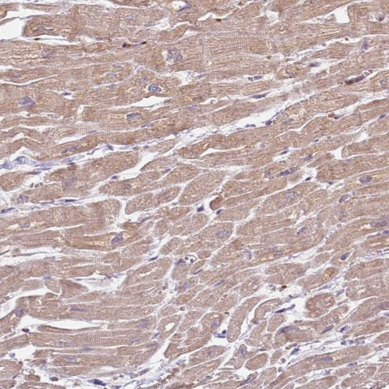 ZFP57 Antibody - BSA Free Immunohistochemistry: ZFP57 Antibody - BSA Free [NBP1-94138]