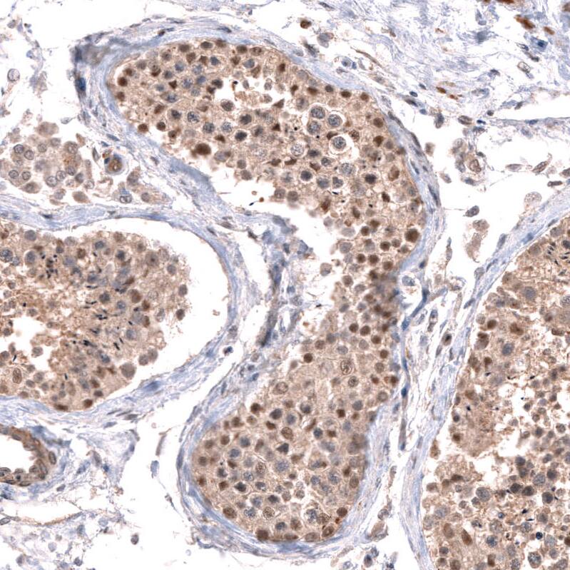 SPATA48 Antibody - BSA Free Immunohistochemistry: SPATA48 Antibody - BSA Free [NBP1-94145]