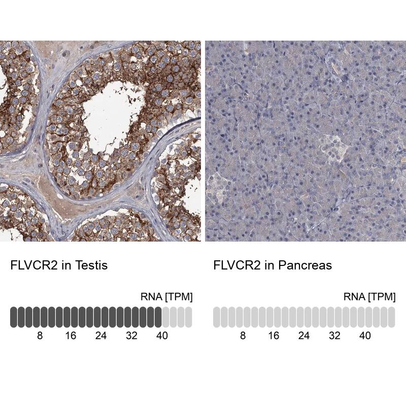 FLVCR2 Antibody - BSA Free Immunohistochemistry: FLVCR2 Antibody - BSA Free [NBP1-94146]