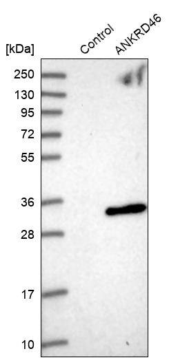 ANKRD46 Antibody - BSA Free Western Blot: ANKRD46 Antibody - BSA Free [NBP1-94147]