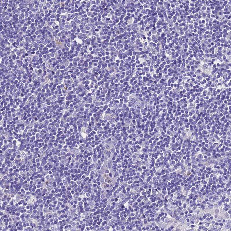 UGT2A1 Antibody - BSA Free Immunohistochemistry: UGT2A1 Antibody - BSA Free [NBP1-94148]