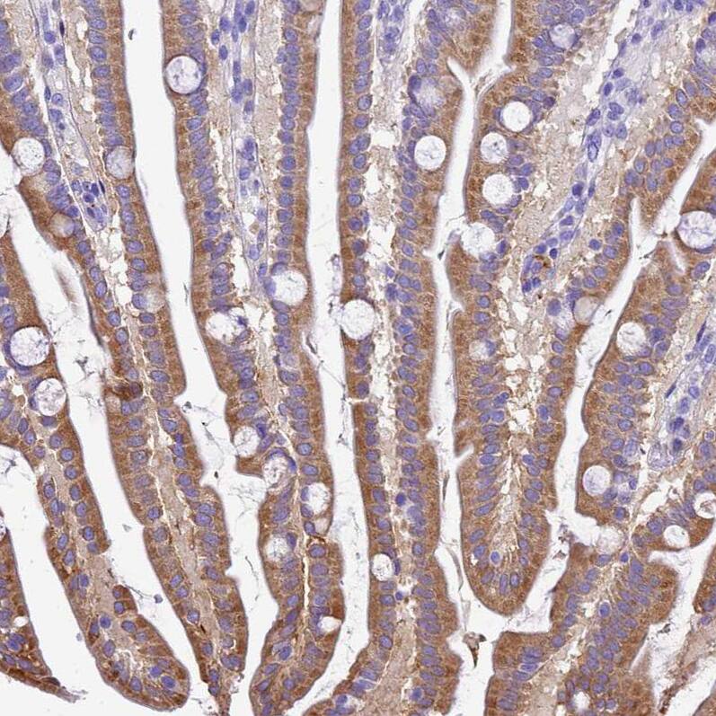 UGT2A1 Antibody - BSA Free Immunohistochemistry: UGT2A1 Antibody - BSA Free [NBP1-94148]