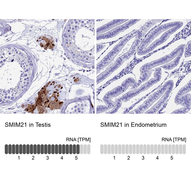 SMIM21 Antibody - BSA Free Immunohistochemistry: SMIM21 Antibody - BSA Free [NBP1-94149]